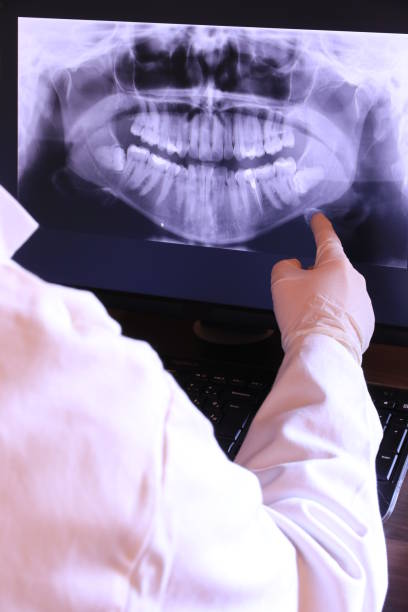 Best Emergency Root Canal Treatment in South Alamo, TX